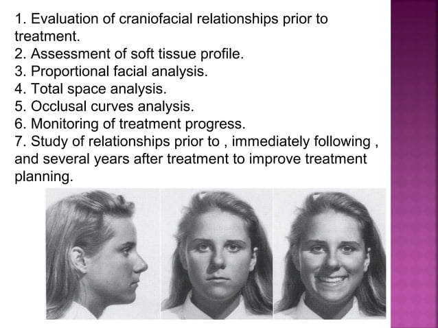 Serial extraction in orthodontic | PPT | Dental Health | Diseases and ...