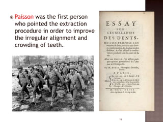  Paisson

was the first person
who pointed the extraction
procedure in order to improve
the irregular alignment and
crowding of teeth.

16

 