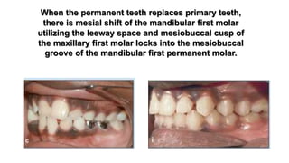 Serial extraction of class i malocclusion