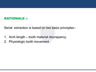 Serial Extraction Definition SERIAL EXTRACTION SLIDESHARE.pptx