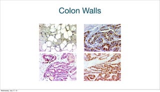 Colon Walls
Wednesday, July 17, 13
 
