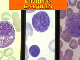 MIELOCITO EOSINOFILO 