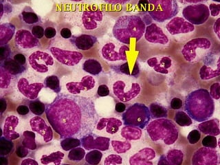 NEUTROFILO BANDA 