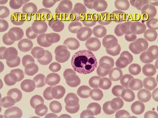 NEUTROFILO SEGMENTADO 