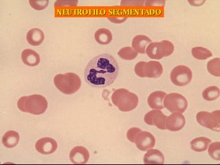 NEUTROFILO SEGMENTADO 