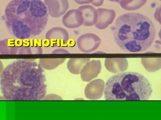 EOSINOFILO 