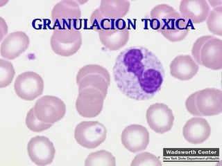 GRANULACION TOXICA 