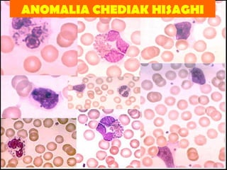 ANOMALIA CHEDIAK HISAGHI 