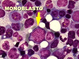 MONOBLASTO 