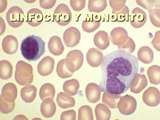 LINFOCITO Y MONOCITO 