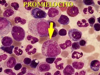PROMIELOCITO 