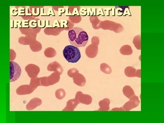 CELULA PLASMATICA IREGULAR 