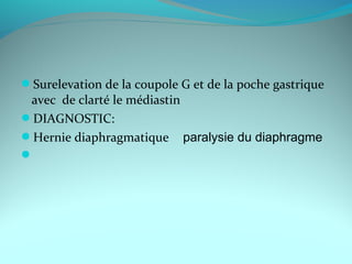 Surelevation de la coupole G et de la poche gastrique
avec de clarté le médiastin
DIAGNOSTIC:
Hernie diaphragmatique paralysie du diaphragme

 
