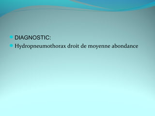 DIAGNOSTIC:
Hydropneumothorax droit de moyenne abondance
 