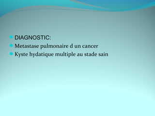 DIAGNOSTIC:
Metastase pulmonaire d un cancer
Kyste hydatique multiple au stade sain
 