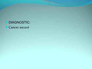 DIAGNOSTIC:
Cancer axcavé
 