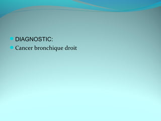 DIAGNOSTIC:
Cancer bronchique droit
 
