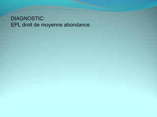 DIAGNOSTIC:
EPL droit de moyenne abondance
 