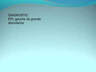 DIAGNOSTIC:
EPL gauche de grande
abondance
 