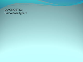 DIAGNOSTIC:
Sarcoïdose type 1
 