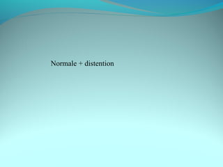 Normale + distention
 