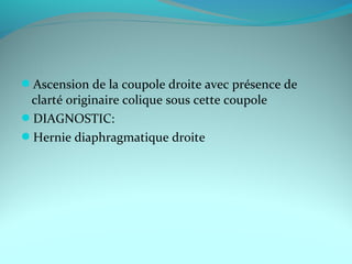 Ascension de la coupole droite avec présence de
clarté originaire colique sous cette coupole
DIAGNOSTIC:
Hernie diaphragmatique droite
 