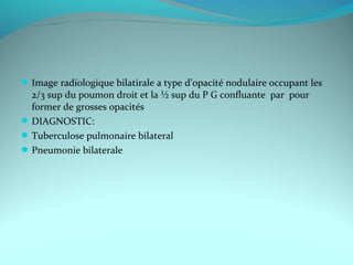 Image radiologique bilatirale a type d’opacité nodulaire occupant les
2/3 sup du poumon droit et la ½ sup du P G confluante par pour
former de grosses opacités
DIAGNOSTIC:
Tuberculose pulmonaire bilateral
Pneumonie bilaterale
 