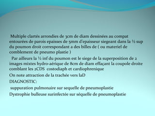 Multiple clartés arrondies de 3cm de diam dessinées au compat
entourées de parois epaisses de 5mm d’epaisseur siegeant dans la ½ sup
du poumon droit correspondant a des billes de ( ou materiel de
comblement de pneumo plastie )
Par ailleurs la ½ inf du poumon est le siege de la superposition de 2
images mixtes hydro-aérique de 8cm de diam effaçant la coupole droite
comblant les 2CDS costodiaph et cardiophrenique
On note attraction de la trachée vers laD
DIAGNOSTIC:
suppuration pulmonaire sur sequelle de pneumoplastie
Dystrophie bulleuse surinfectée sur séquelle de pneumoplastie
 