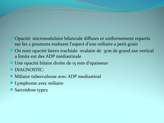 Opacité micronodulaire bilaterale diffuses et uniformement repartis
sur les 2 poumons realisant l’aspect d’une miliaire a petit grain
On note opacité latero trachiale ovalaire de 3cm de grand axe vertical
a limite ext des ADP médiastinale
Une opacité hilaire droite de 15 mm d’epaisseur
DIAGNOSTIC:
Miliaire tuberculeuse avec ADP mediastinal
Lymphome avec miliaire
Sarcoidose type2
 
