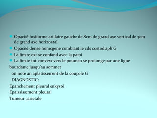 Opacité fusiforme axillaire gauche de 8cm de grand axe vertical de 3cm
de grand axe horizontal
Opacité dense homogene comblant le cds costodiaph G
La limite ext se confond avec la paroi
La limite int convexe vers le poumon se prolonge par une ligne
bourdante jusqu’au sommet
on note un aplatissement de la coupole G
DIAGNOSTIC:
Epanchement pleural enkysté
Epaississement pleural
Tumeur parietale
 