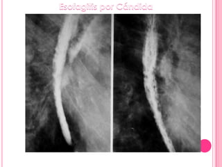 Serie esofagogastroduodenal