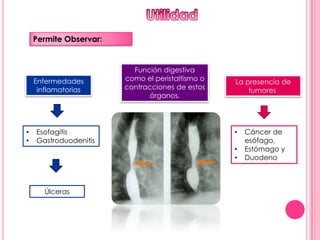 Permite Observar:


                          Función digestiva
    Enfermedades        como el peristaltismo o   La presencia de
     inflamatorias      contracciones de estos        tumores
                               órganos.




•   Esofagitis                                    •   Cáncer de
•   Gastroduodenitis                                  esófago,
                                                  •   Estómago y
                                                  •   Duodeno



       Úlceras
 