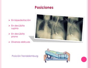  En bipedestación

 En decúbito
  supino

 En decúbito
  prono

 Diversas oblicuas




  Posición Trendelemburg
 