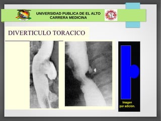 UNIVERSIDAD PUBLICA DE EL ALTO
CARRERA MEDICINA
 