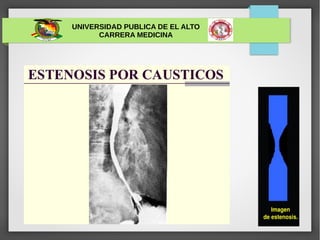 UNIVERSIDAD PUBLICA DE EL ALTO
CARRERA MEDICINA
 