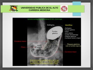 UNIVERSIDAD PUBLICA DE EL ALTO
CARRERA MEDICINA
 