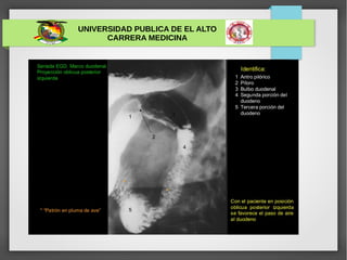 UNIVERSIDAD PUBLICA DE EL ALTO
CARRERA MEDICINA
 