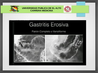 UNIVERSIDAD PUBLICA DE EL ALTO
CARRERA MEDICINA
 