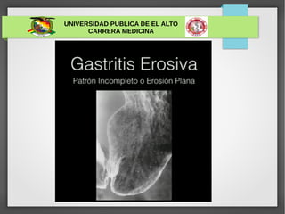 UNIVERSIDAD PUBLICA DE EL ALTO
CARRERA MEDICINA
 