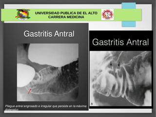 UNIVERSIDAD PUBLICA DE EL ALTO
CARRERA MEDICINA
 