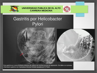 UNIVERSIDAD PUBLICA DE EL ALTO
CARRERA MEDICINA
 