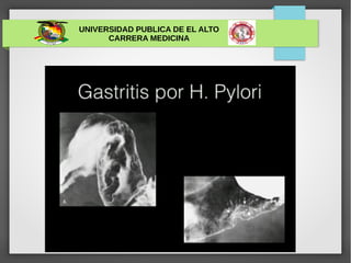 UNIVERSIDAD PUBLICA DE EL ALTO
CARRERA MEDICINA
 