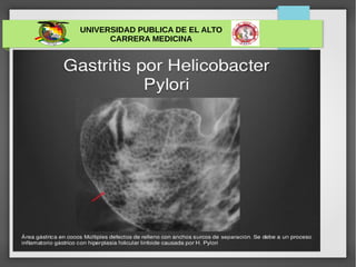 UNIVERSIDAD PUBLICA DE EL ALTO
CARRERA MEDICINA
 