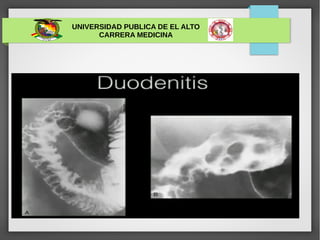 UNIVERSIDAD PUBLICA DE EL ALTO
CARRERA MEDICINA
 