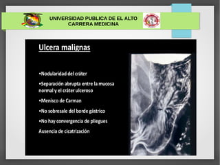 UNIVERSIDAD PUBLICA DE EL ALTO
CARRERA MEDICINA
ULCERA GÁSTRICA
 