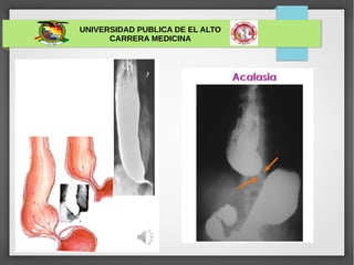 UNIVERSIDAD PUBLICA DE EL ALTO
CARRERA MEDICINA
 