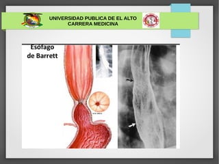 UNIVERSIDAD PUBLICA DE EL ALTO
CARRERA MEDICINA
 