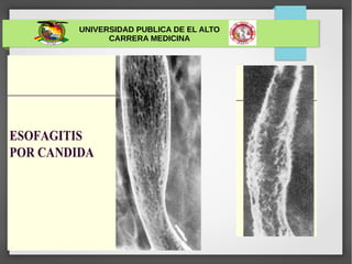 UNIVERSIDAD PUBLICA DE EL ALTO
CARRERA MEDICINA
 