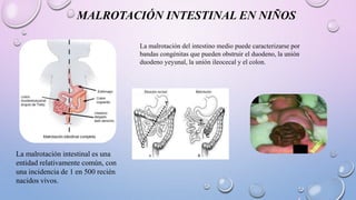 serie-esogastrodeudonal-nuevo-pptx