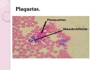 Plaquetas.